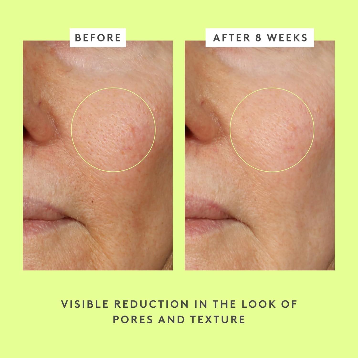 imageDrunk Elephant TLC Framboos Glycolic Serum Exfoliating AHA Serum Clean Clinical Skincare CrueltyFree DermatologistTested Free of Essential Oils Silicones and Fragrance169 Fl Oz Pack of 1